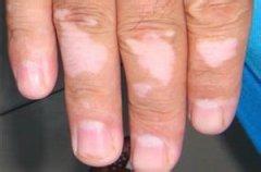 u=450845079,2965337567&fm=21&gp=0.jpg